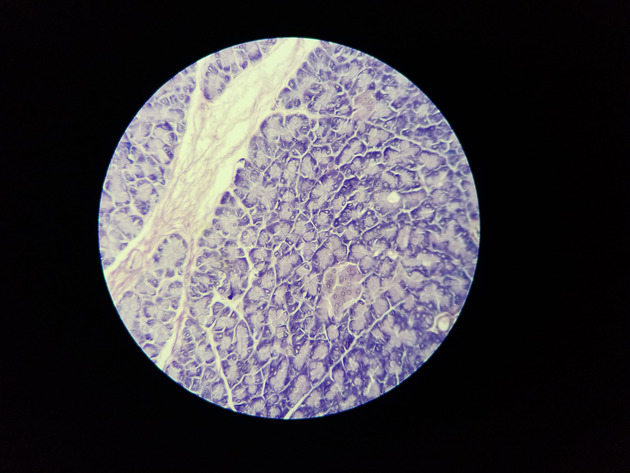 Pancreas Slides - Pancreas 010 100X